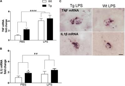 Diverse Protein Profiles in CNS Myeloid Cells and CNS Tissue From Lipopolysaccharide- and Vehicle-Injected APPSWE/PS1ΔE9 Transgenic Mice Implicate Cathepsin Z in Alzheimer’s Disease